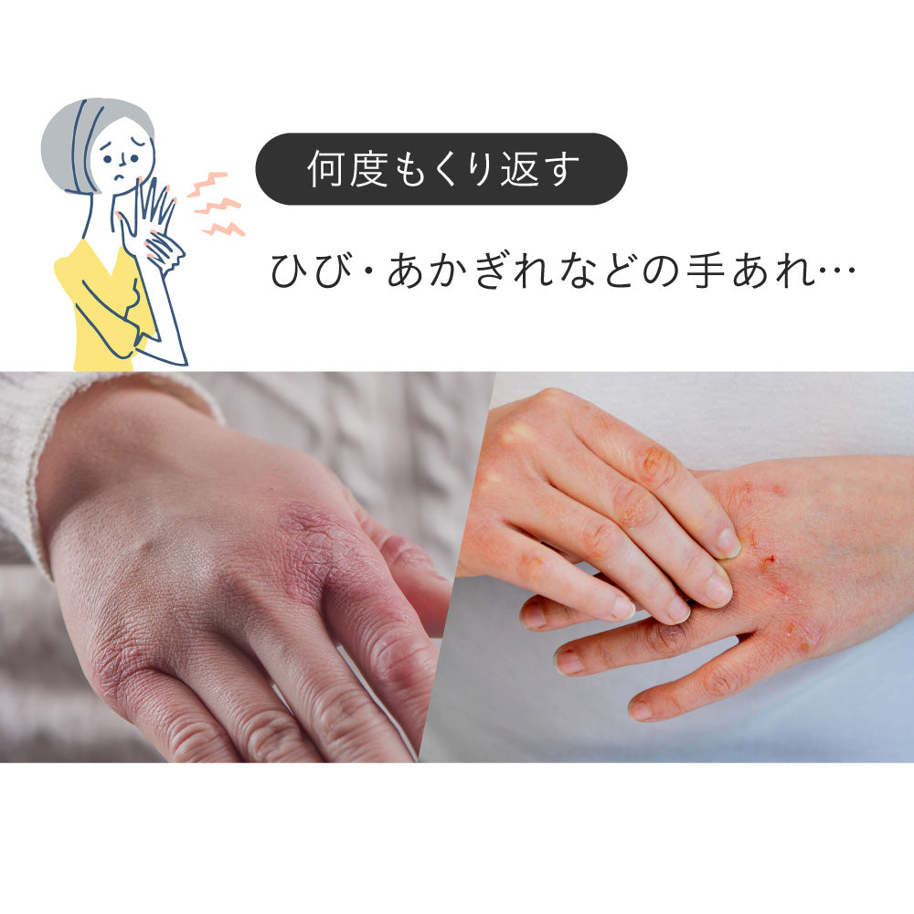 ILUS 薬用ハンドクリーム
